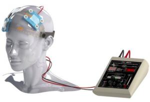 تجربه استفاده از TDCS در کلینیک طراوت تهرانسر