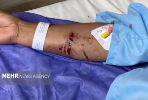 دادستان فومن: برخی گروه‌ها مانع ساماندهی سگ‌ های ولگرد می‌شوند