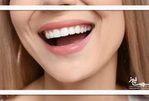 ژل نوآورانه‌ای که مینای دندان را ظرف چند هفته بازسازی می‌کند