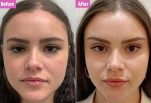 بهترین پزشک برای لیفت صورت با نخ + معرفی ۱۰ پزشک برتر