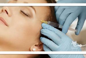 فیلر یا ژل چیست و چرا باید توسط پزشک متخصص تزریق شود؟