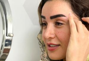 کاشت ابرو طبیعی؛ بازگرداندن زیبایی و اعتمادبه‌نفس با علم روز