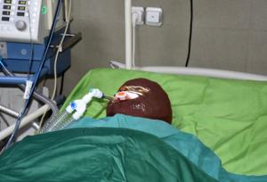 ماجرای اسیدپاشی هولناک روی پدر و دختر در تهران