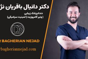 قبل از مراجعه به دندانپزشک زیبایی در اصفهان، این 5 نکته را از دست ندهید!