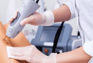 لیزر موهای زائد روی پوست آسیب دیده