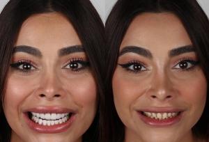 بهترین دندانپزشک زیبایی در تهران + لیست ۱۰ دندانپزشک برتر