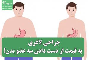 جراحی لاغری به قیمت از دست دادن سه عضو بدن!