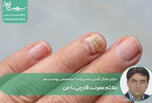 علائم عفونت قارچی ناخن