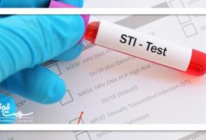 سوالات متداول در مورد بیماری های مقاربتی