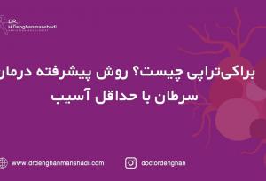 براکی‌تراپی چیست؟ روش پیشرفته در سرطان با حداقل آسیب