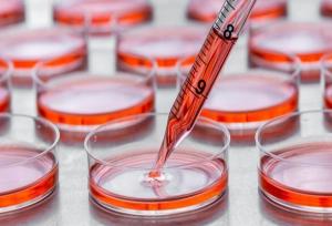 جذب داوطلب اهدای سلول بنیادی برای اولین بار در نماز جمعه