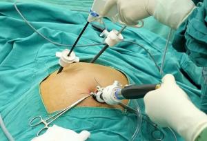 هیستروسکوپی و لاپاراسکوپی زنان؛ درمان ناباروری و موفقیت IVF