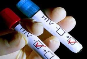 آزمایش رایگان و محرمانه اچ‌.آی‌.وی در هرمزگان