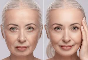 چه سرمی برای لیفت صورت خوبه؟