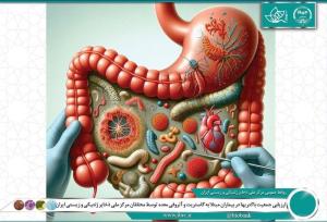 محققان ایرانی ترکیب میکروبی معده بیماران را بررسی کردند