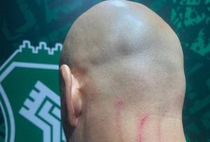 جراحت مربی دروازه‌بان‌های استقلال در پایان بازی با خیبر