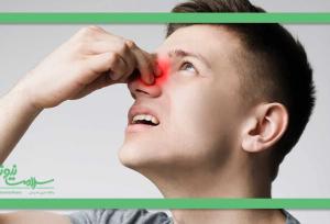 علائم و نشانه‌های پولیپ بینی