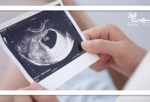 آیا سن محدودیتی برای بارداری زنان ایجاد می‌کند؟