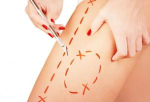 جراحی لیفت ران چیست و به چه روش هایی انجام می شود؟