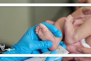 غربالگری نوزادان پیشگیری از عوارض مادام‌العمر کم‌کاری تیروئید