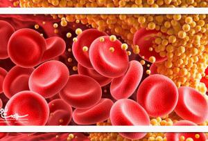 درمان ژنی تازه‌ای که می‌تواند کلسترول را برای همیشه از بین ببرد