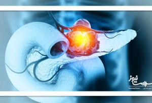 گامی بزرگ در درمان یکی از مرگبارترین سرطان‌ها