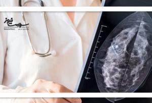 توسعه سامانه هوشمند تشخیص زودرس سرطان پستان در ایران / دومین پایگاه داده ماموگرافی جهان ایجاد شد