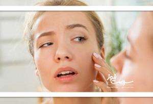 چرا گاهی صورت افراد  ورم می‌کند؟