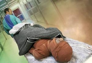 کمبود هزار تخت بیمارستانی سوختگی در کشور