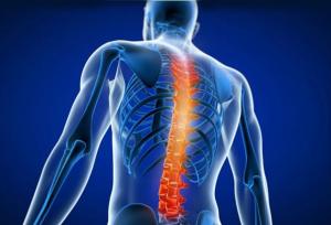 بلوک‌ های عصبی در درمان التهاب مفاصل کمر