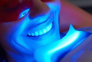 راهنمای کامل بلیچینگ دندان در تهران