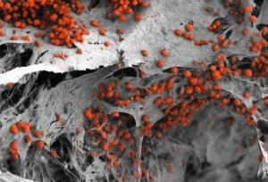 کارخانه خون‌سازی مغز استخوان انسان در آزمایشگاه ساخته شد