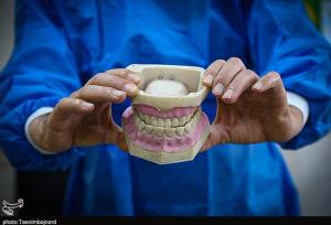 پوشش بیمه‌ای خدمات دندانسازی کامل نیست/ هشدار درباره دندانسازی‌های غیرمجاز