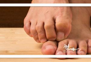 بی‌حسی پاها از زانو به پایین؛ زنگ خطری برای سلامت عصبی و عروقی