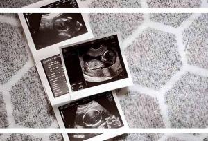 مراقبت های سه ماهه دوم بارداری؛ توصیه‌های کلیدی متخصصان برای سلامت مادر و جنین