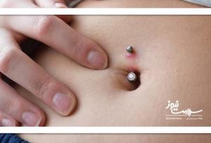 عفونت ناف می‌تواند خطرناک یا حتی مرگبار باشد