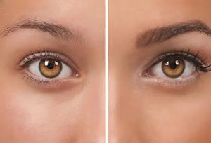 کاشت ابرو در مشهد ؛ انتخابی که می‌تواند چهره و اعتماد به‌ نفس را متحول کند