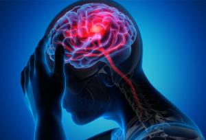 سکته مغزی در ایران دومین علت مرگ‌ومیر است