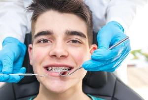 لق شدن روکش دندان می‌تواند نشانه‌ای از پوسیدگی پنهان باشد