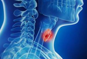 افزایش آمار تشخیص بدخیمی‌های تیروئیدی