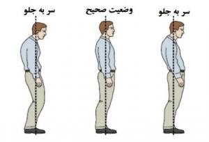 تمرینات اصلاحی برای رفع ناهنجاری «سر به جلو»