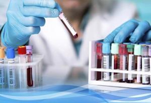 کارشناسان علوم آزمایشگاهی در انتظار شماره نظام پزشکی!