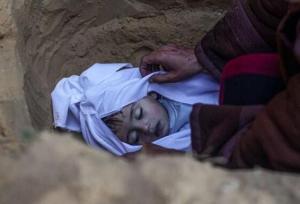 افزایش تأمل‌برانگیز تولد نوزادان نارس در غزه