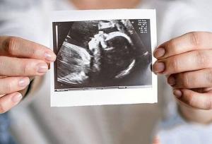 حمایت روانی، مهم‌ترین عامل تداوم بارداری است