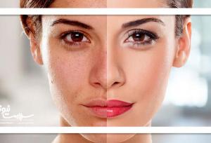 بهترین خوراکی‌ها برای داشتن پوست درخشان