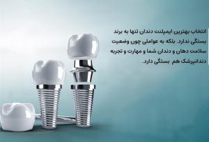 بهترین برندهای ایمپلنت دندان در ایران از نگاه متخصصان