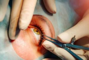 عملی که چشم سالم را معیوب می‌کند / خطر تغییر رنگ چشم برای افراد سالم