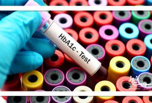 قند ناشتا طبیعی اما HbA1c بالا؟