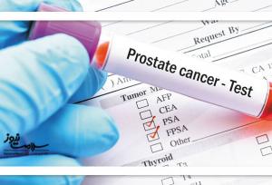 تست جدید و پیشرفته تشخیص سرطان پروستات