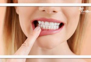 آیا مراقبت از دندان‌ها می‌تواند از زوال عقل پیشگیری کند؟